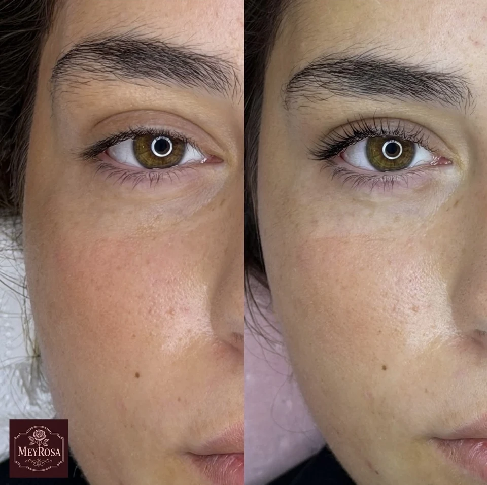 Meyrosa — lash lifting 1